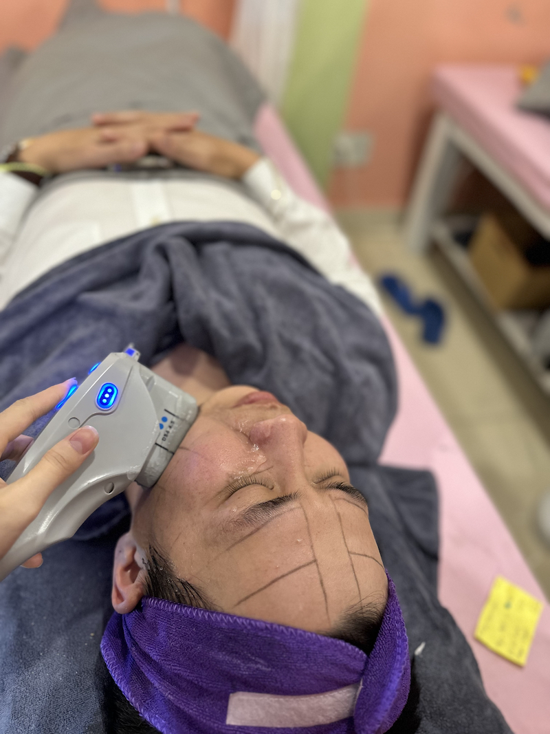 Cách xóa nếp nhăn khóe miệng hiệu quả quận 10 - Quynh's Spa