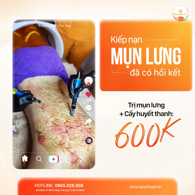 Kiếp nạn mụn lưng đã có hồi kết - Quynh’s Spa quận 10