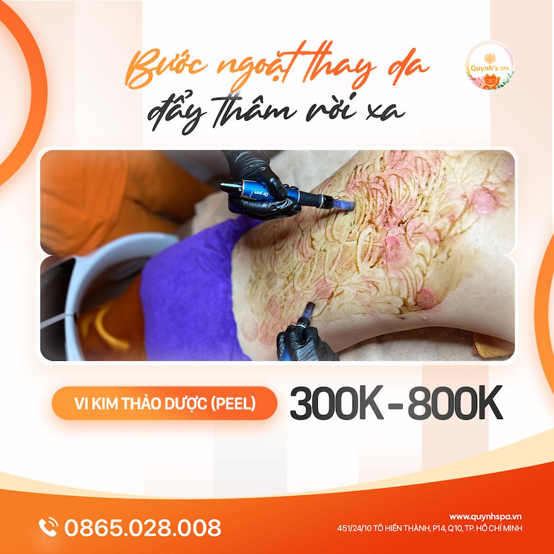 Thay da xóa thâm cùng Quynh's Spa quận 10