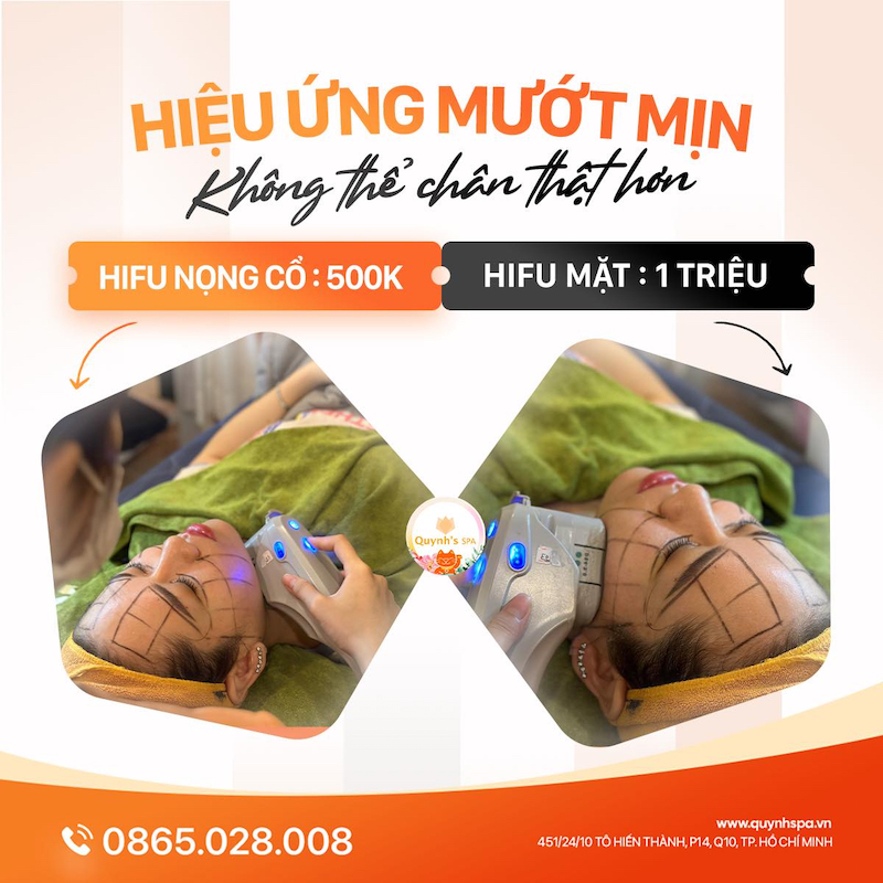 Hifu tạo hiệu ứng mướt mịn - Quynh's SPa quận 10