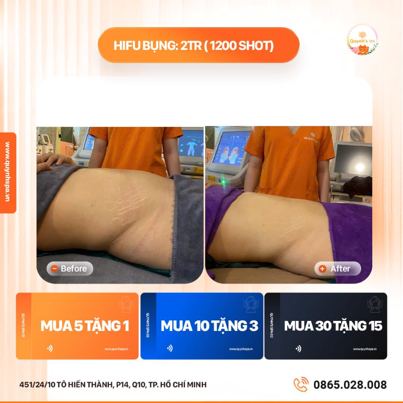Cập nhật tiến trình giảm mỡ đón Tết của chị em Nhà Quỳnh Spa quận 10