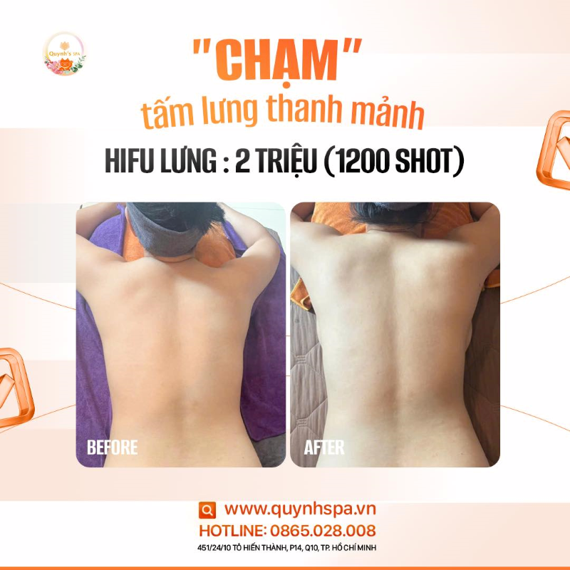 “Chạm” tấm lưng nõn nà thanh mảnh cùng Hifu Body - Quynh's Spa Quận 10