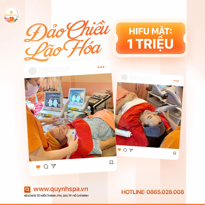 Đảo chiều lão hoá cùng Hifu tại Quynh's Spa Quận 10