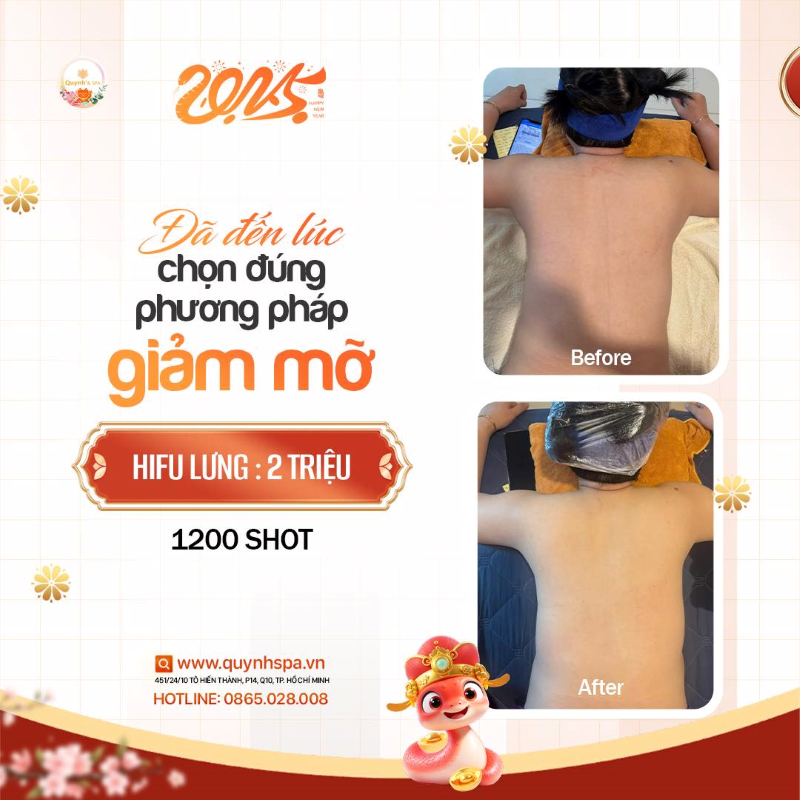 Đã đến lúc chọn đúng phương pháp giảm mỡ rồi nàng ơi - Hifu Body tại Quynh's Spa Q10