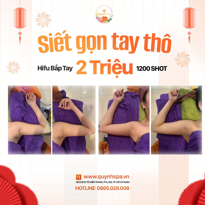 Dọn sạch mỡ béo - Siết gọn tay thô cùng Hifu bắp tay Quynh's Spa Q10