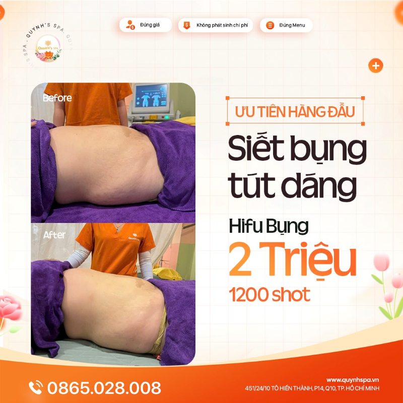 Ơ kìa! Nàng đã kịp siết bụng đón Lễ chưa cùng Hifu Bụng tại Quynh's Spa TP.HCM