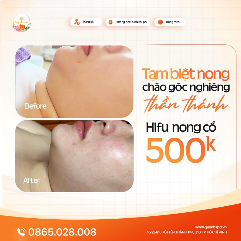 Chứng nhận góc nghiêng đẹp miễn bàn tại Quynh's Spa Q.10