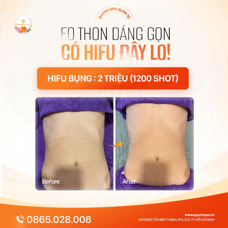 Dừng hết liệu trình tập luyện đi vì đã có Hifu Bụng ở đây rồi