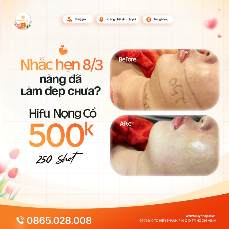 Ngày mai là 8/3 - Nàng đừng chần chờ làm đẹp nữa cùng Hifu nọng cổ Quynh's Spa Q10