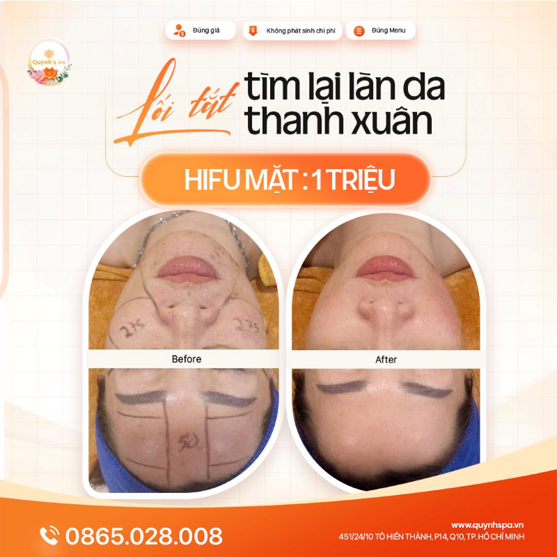 Lối tắt quay ngược thời gian cho làn da tại Quynh's Spa TP.HCM