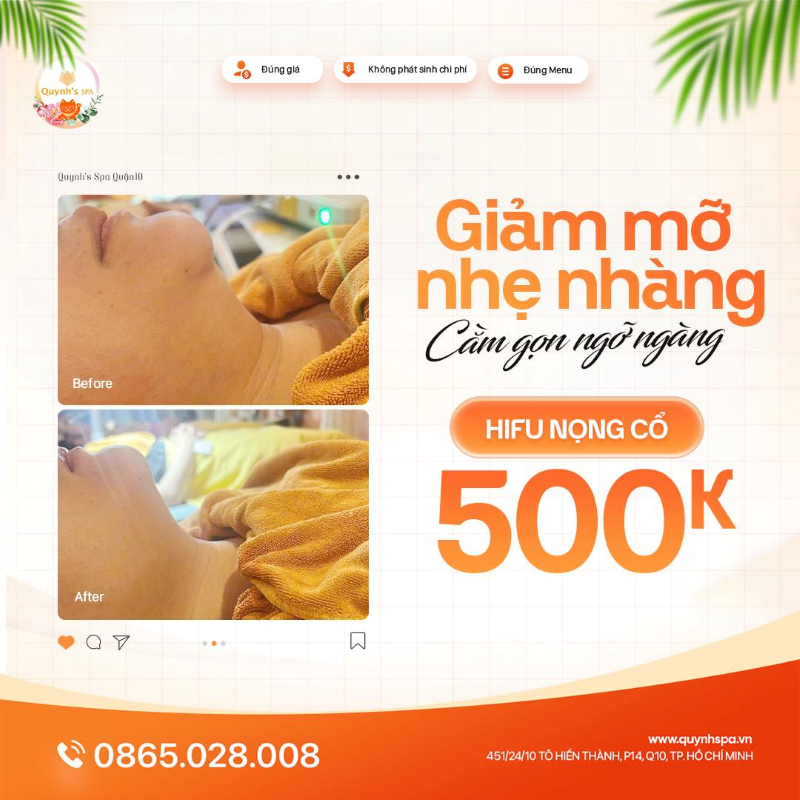 Giảm mỡ nhẹ nhàng - Cằm gọn ngỡ ngàng cùng Hifu nọng cổ tại Quynh's Spa quận 10