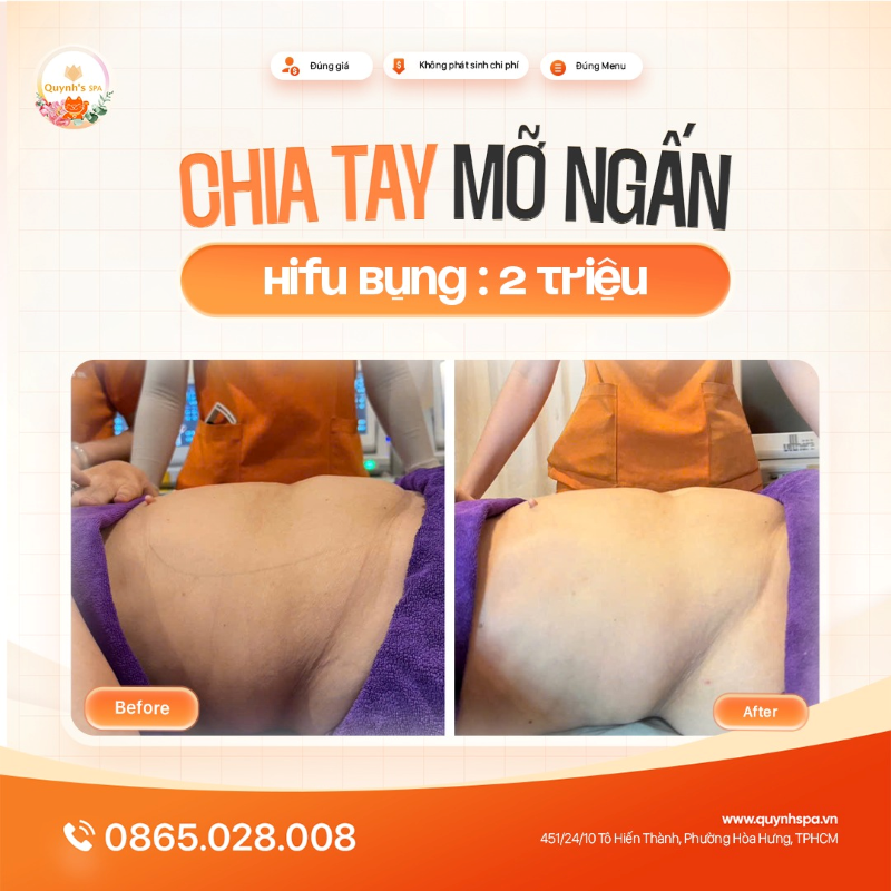 Chia tay mỡ ngấn - Nhẹ nhõm nào bằng với Hifu bụng Quynh's Spa Q.10