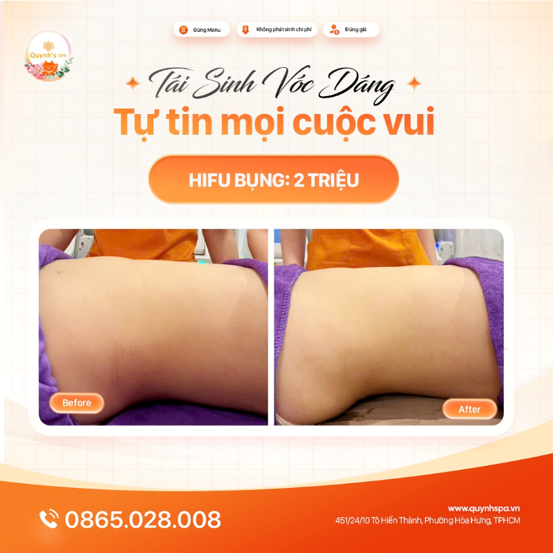 Tái sinh vóc dáng - Tỏa sáng mọi cuộc vui cùng Hifu bụng tại Quynh's Spa Q.10