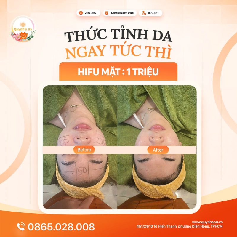Ai nói cải thiện da phải lâu? Nhìn kết quả da khách Nhà Quỳnh, bạn sẽ phải bất ngờ