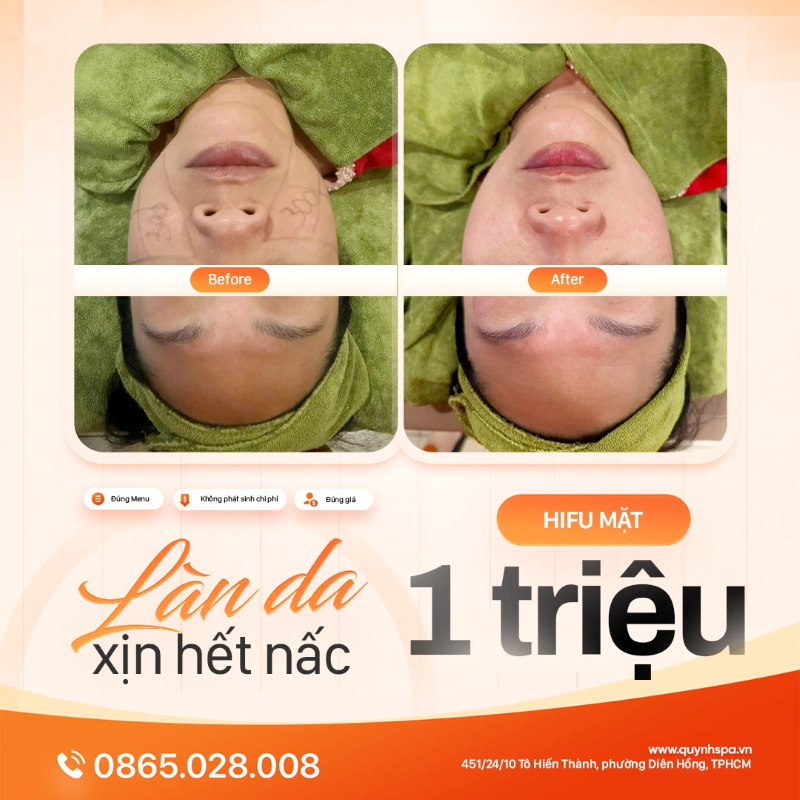 Chăm da hết công suất - Nhận lại kết quả xịn hết nấc