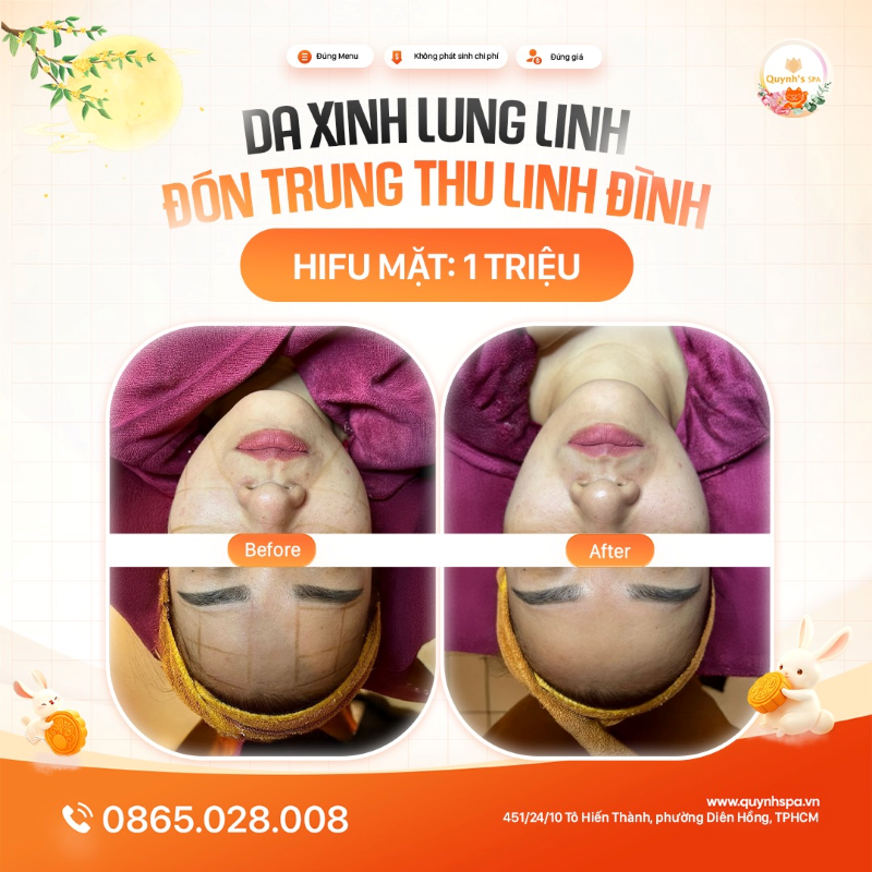 Nàng có hẹn chăm da đón trung thu tại Nhà Quỳnh với Hifu mặt