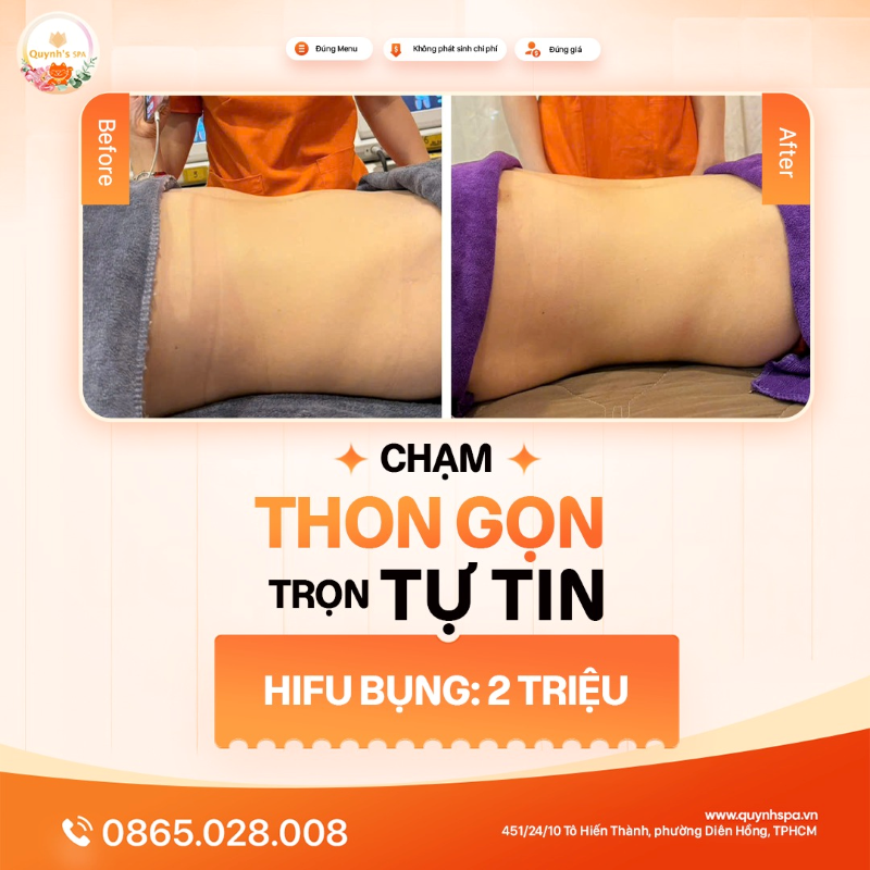 Chạm thon gọn - Trọn tự tin với hifu bụng tại Quynh's Spa quận 10