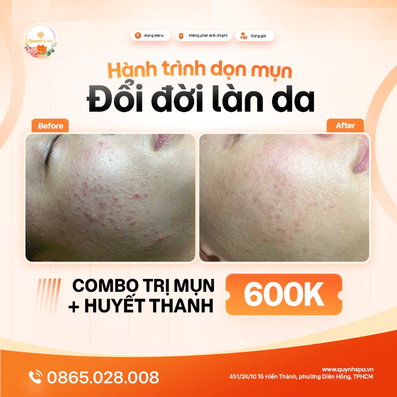 Hành trình đổi đời làn da cần bắt đầu ngay từ hôm nay