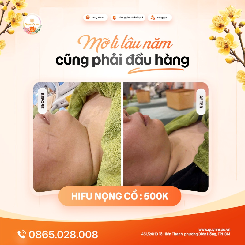 Mỡ lì lâu năm cũng phải đầu hàng với Hifu nọng cổ tại Quynh' Spa P. Diên Hồng