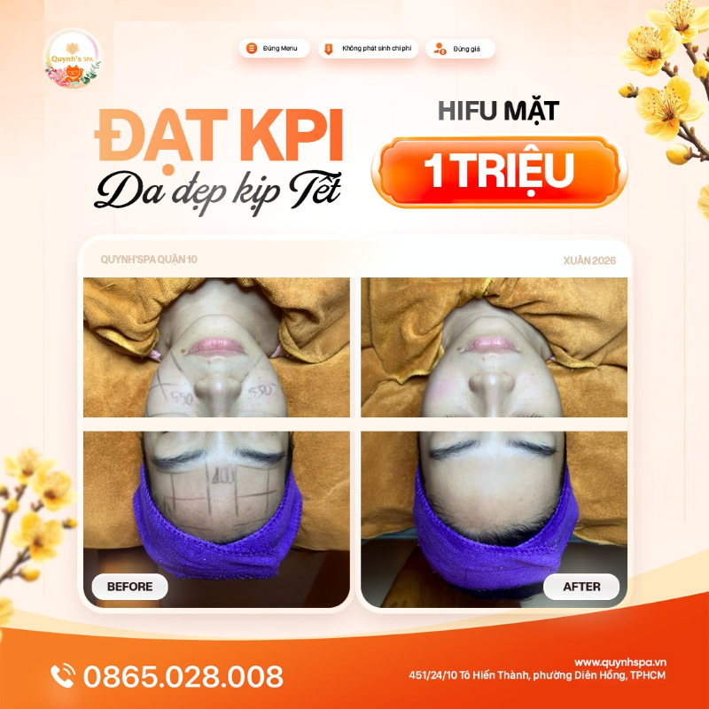 +1 máy đạt KPI da đẹp kịp Tết tại Quynh' Spa quận 10