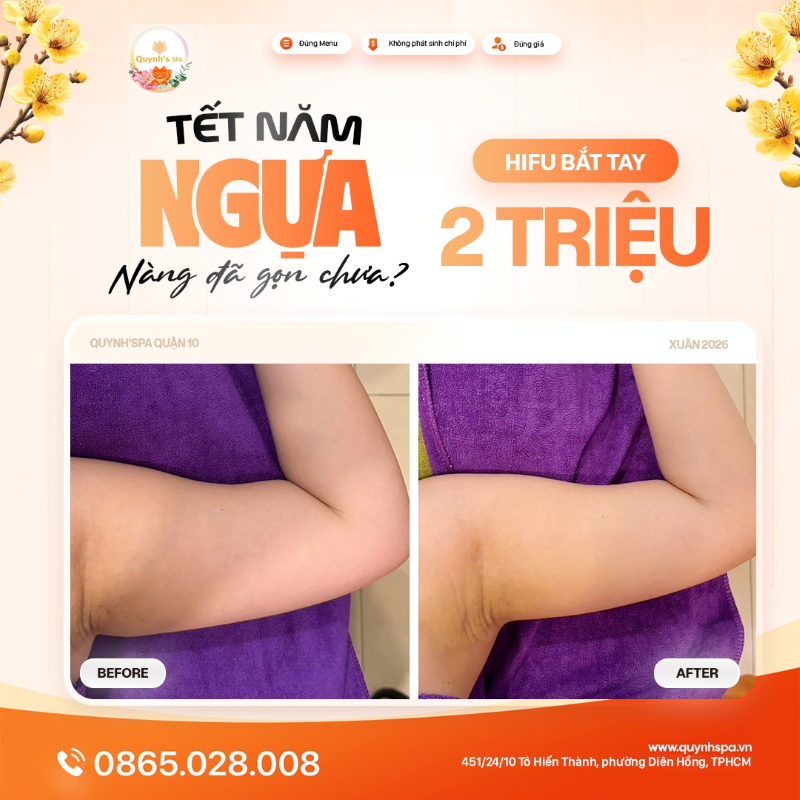 Tết năm ngựa - Nàng đã gọn chưa với hifu bắp tay tại Quynh's Spa Q.10