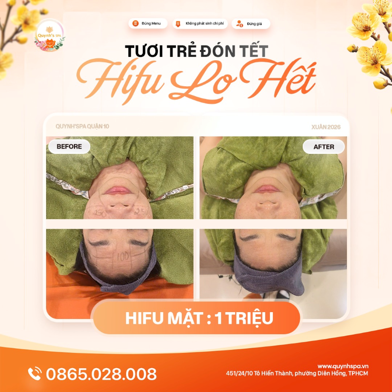 Tươi trẻ đón Tết - Hifu lo hết với Hifu trẻ hóa tại Quynh's Spa Q.10