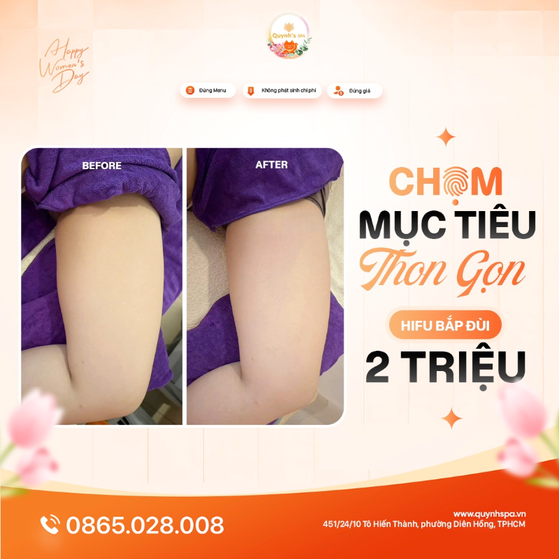 Chạm mục tiêu thon gọn đầu năm với Hifu đùi Quynh' Spa phường Diên Hồng