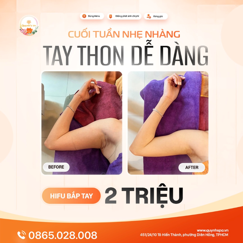 Cuối tuần nhẹ nhàng - Tay thon gọn gàng với Hifu bắp tay Quynh's Spa Q.10