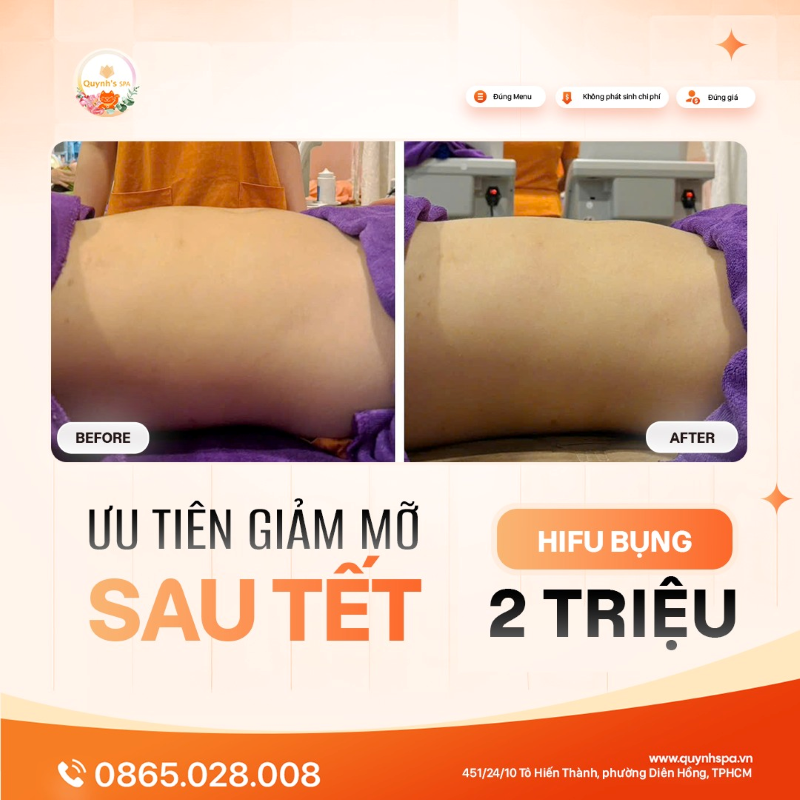 Giảm mỡ bụng - Ưu tiên hàng đầu sau Tết với Hifu bụng Quynh's Spa Q.10