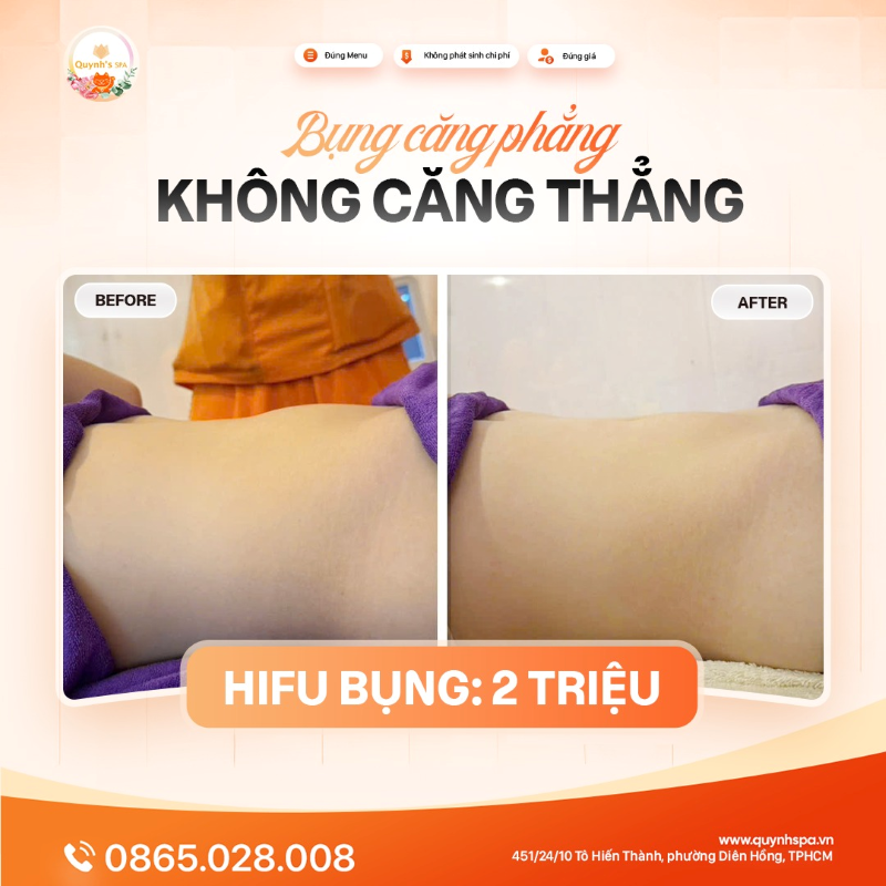 Hết Tết, bụng căng phẳng - không căng thẳng nàng nha! Hết Tết, bụng căng phẳng - không căng thẳng nàng nha!