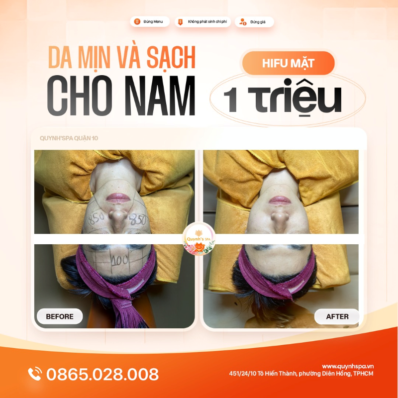 Nam giới cũng cần một làn da mịn và sạch - Quynh's Spa Q10