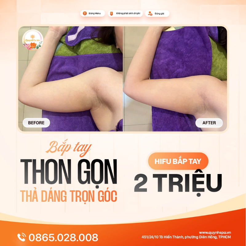 Nếu mỡ thừa làm nàng phiền muộn thì chọn ngay Hifu