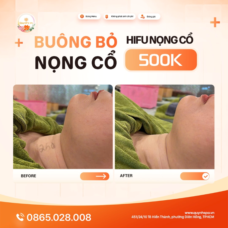 Buông bỏ nọng cổ với Hifu nọng cổ tại Quynh' Spa quận 10