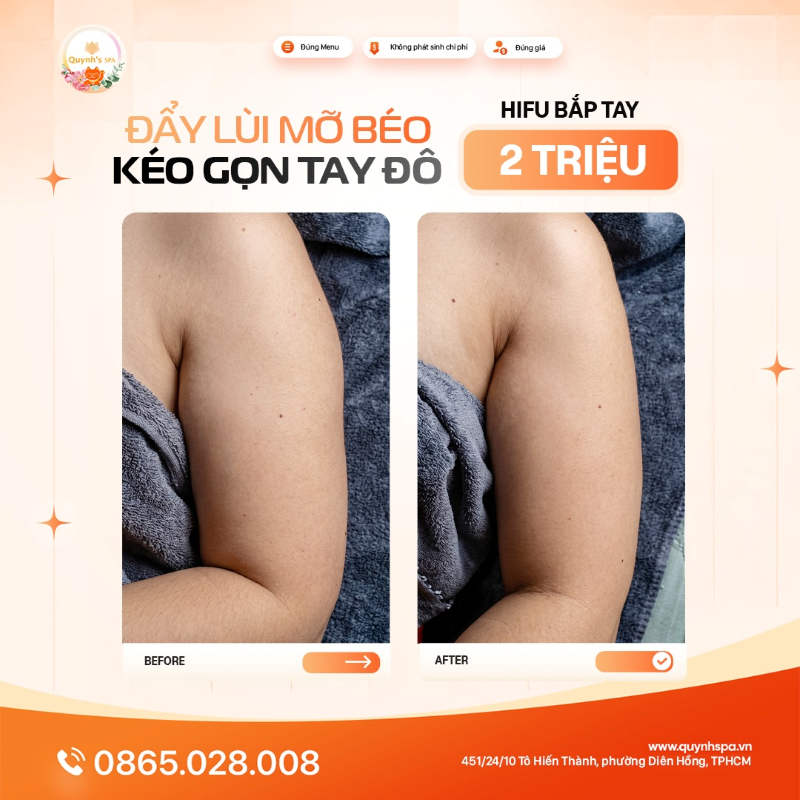 Đẩy lùi mỡ béo - Kéo gọn tay đô với Hifu Quynh' Spa quận 10