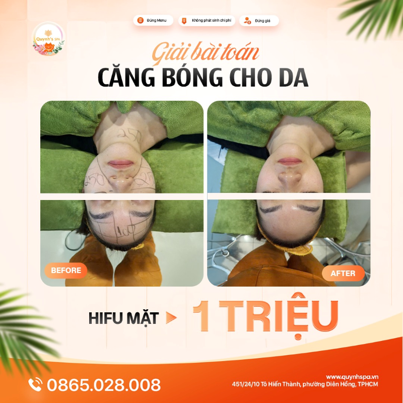 Giải bài toán căng bóng cho da với Hifu mặt tại TP.HCM
