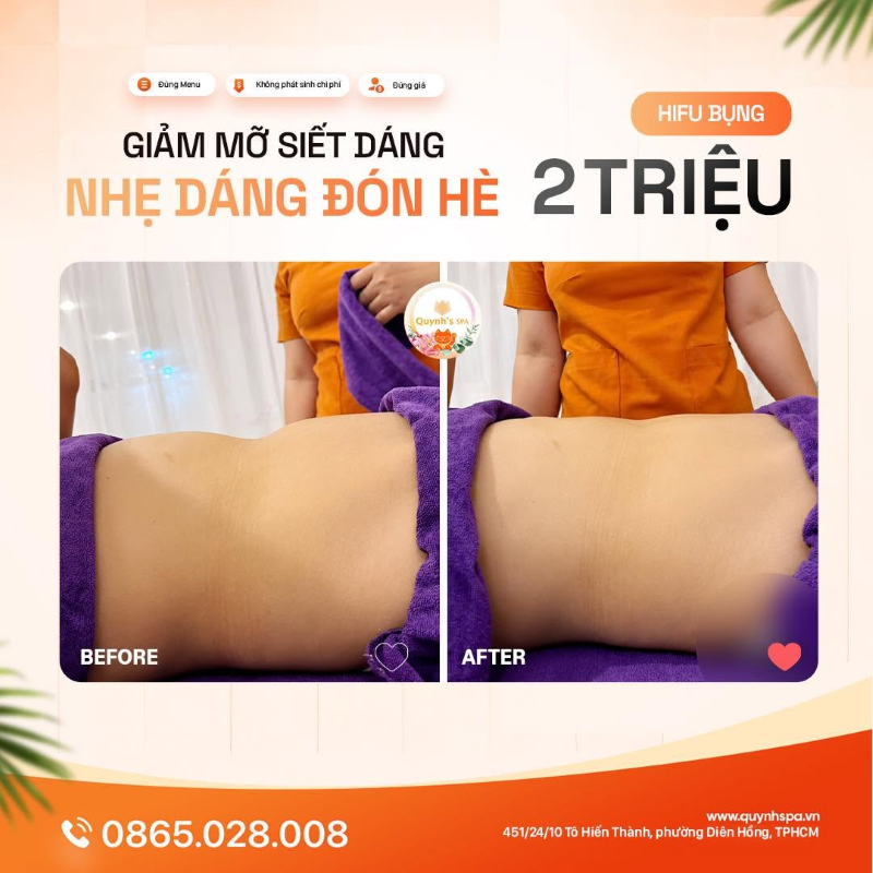 GIẢM MỠ SIẾT DÁNG — NHẸ DÁNG ĐÓN HÈ với Hifu bụng Quynh' Spa Q.10