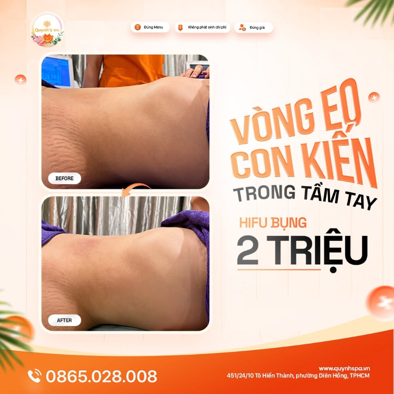 Hifu có giảm mỡ được nhiều không em hay chỉ giảm chút chút thôi