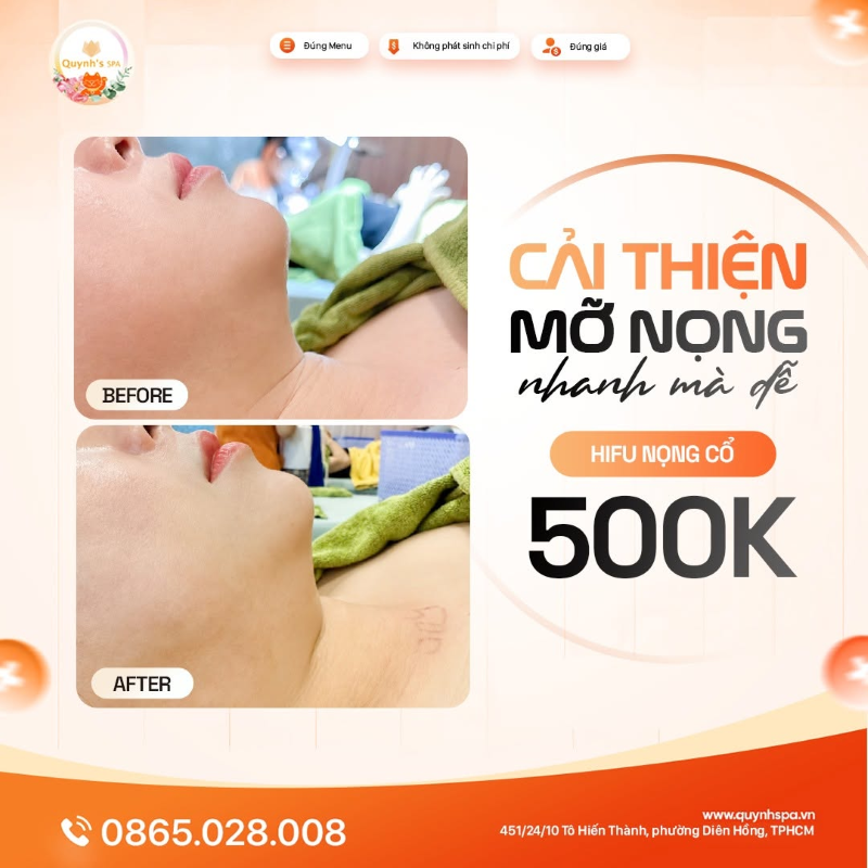 Không tin mỡ nọng có thể cải thiện nhanh thế được