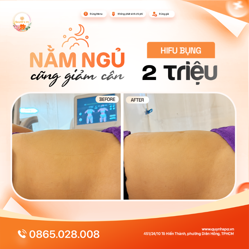 Nằm ngủ giảm cân có thật không với HIFU bụng tại Quỳnh Spa phường Diên Hồng